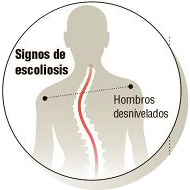 COLUMNA-NORMAL-ESCOLIOSIS