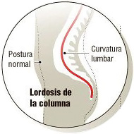 COLUMNA-NORMAL-HIPERLORDOSI